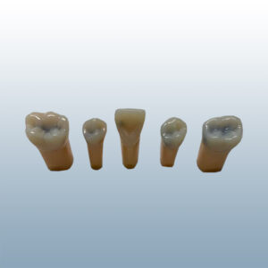 Caries-teeth