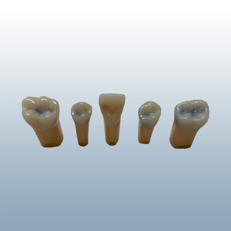 Kilgore Replacement Teeth - Caries