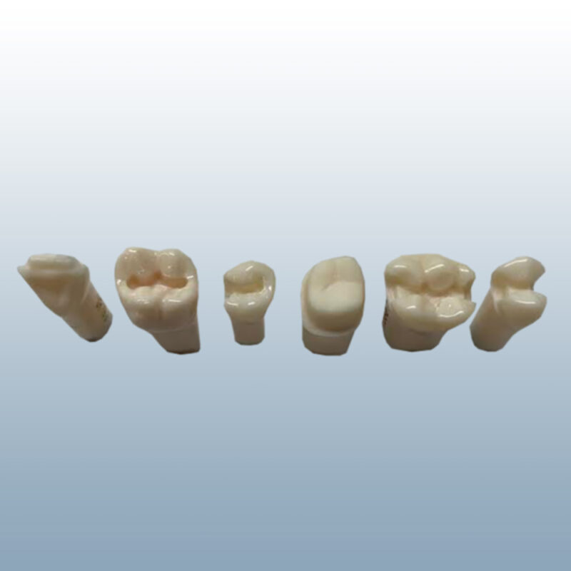 cavity prep