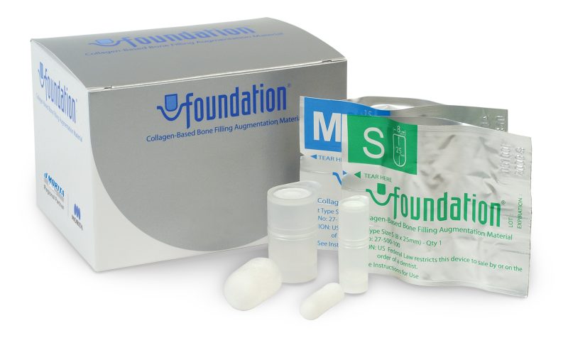 Foundation Bone Filling Augmentation Material