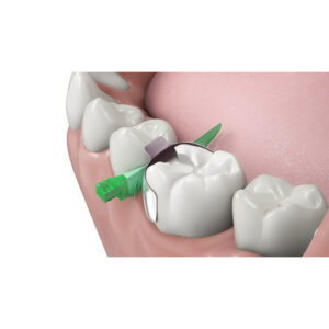 Composi-Tight 3D Fusion Full Curve Matrix Bands