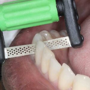 GARRISON FitStrip Interproximal Finishing and Contouring Strip Refills